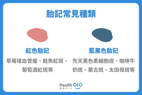 左手背胎記|胎記怎麼產生、何時消除？醫師剖析胎記種類、胎記寓意